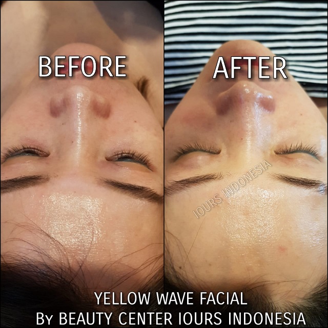 Beauty Treatment